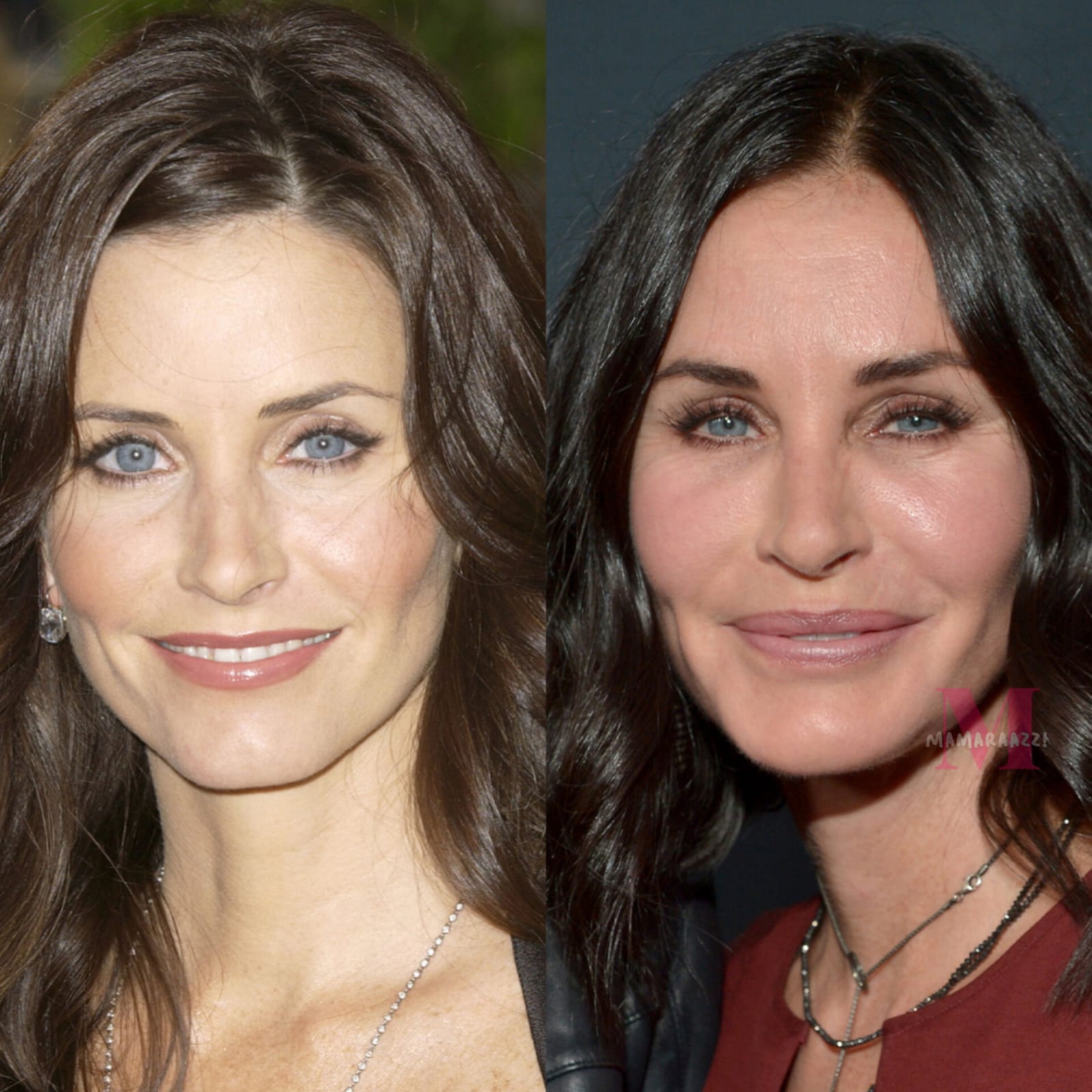 Courteney Cox Confesses She Messed Up By Overdoing With The Fillers Mamaraazzi